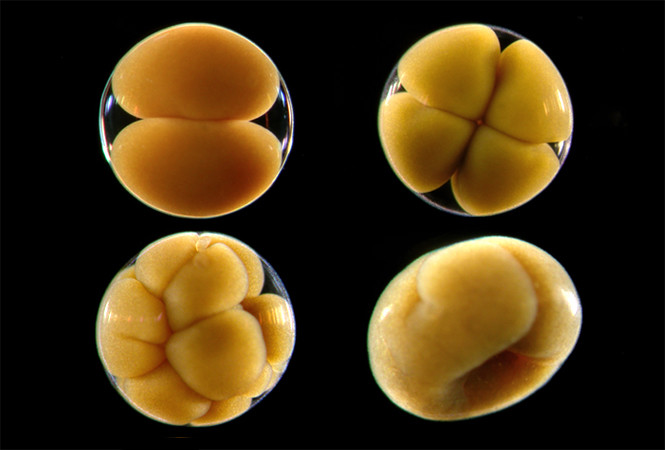 怀孕第三周一粒种子的诞生，宝宝成了桑葚状子宫成了鸭梨样
