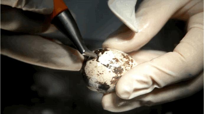 牙医科普洗牙,鹌鹑蛋洗牙后遗症