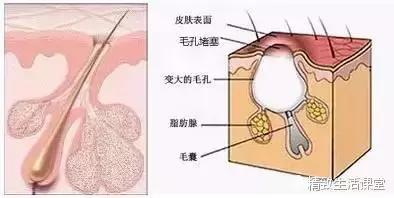 平滑零毛孔速成美肌,毛孔自由呼吸轻松拥有轻透肌