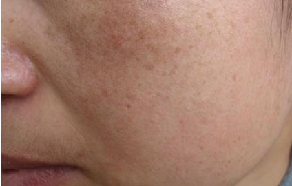 怀孕七个月腋窝和乳房变黑吗,怀孕脖子和腋窝黑是什么原因