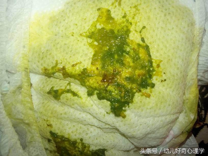 宝宝拉肚子20多天了反反复复,宝宝拉肚子拉绿色稀水怎么治疗