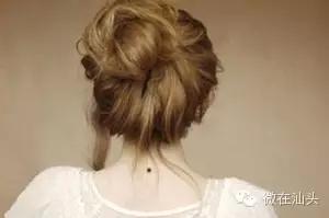 一图读懂什么样的痣易癌变,点痣后增生了肉痣会变癌吗