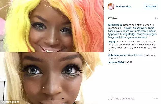 韩式卧蚕眼,韩国卧蚕眼