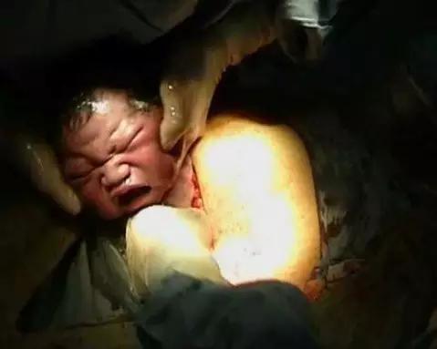 芈月难产为什么这么厉害,芈月生孩子难产大王发火