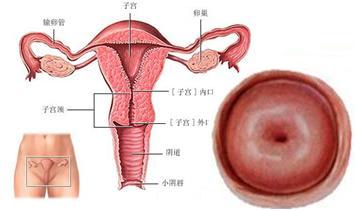宫颈肥大会导致不孕？听听妇科医生怎么说！