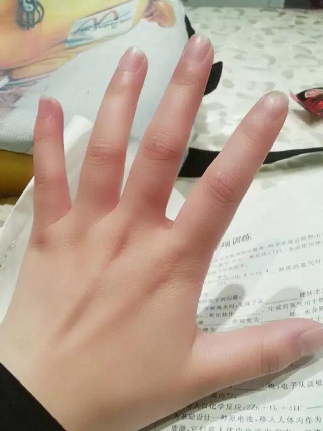 网络热传治冻疮良方,你一定用得着!