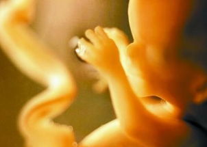 脐带长度异常原因,脐带异常是什么原因引起的