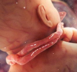 脐带长度异常原因,脐带异常是什么原因引起的