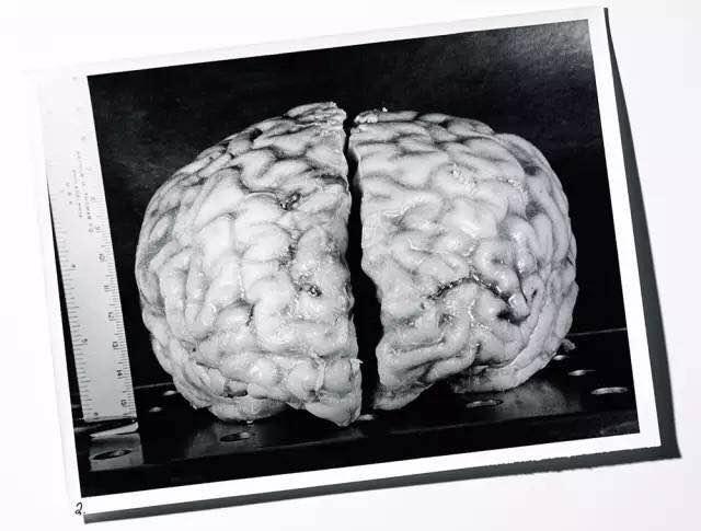 什么方法让头脑瞬间清醒,上班很困瞬间清醒的方法