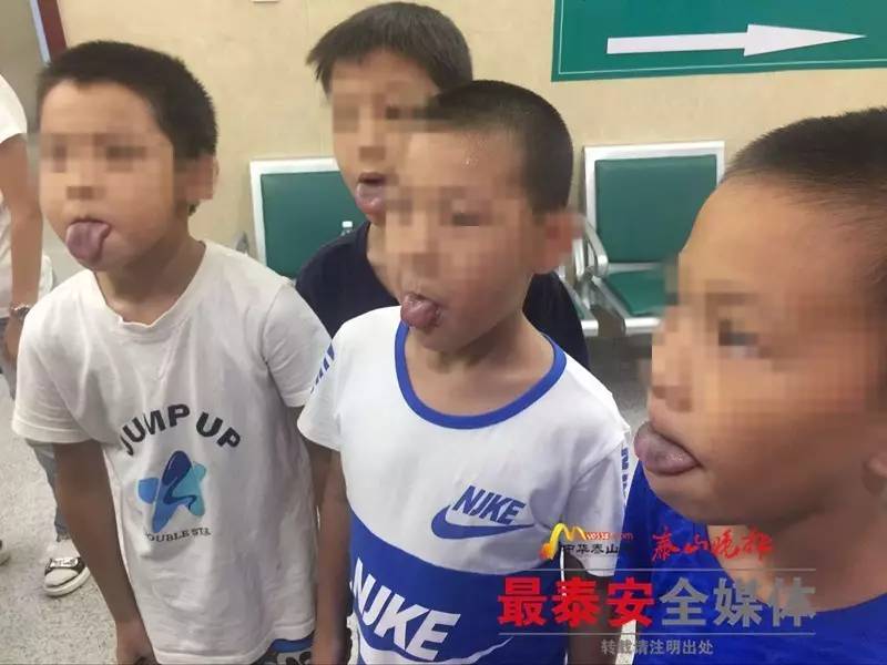 速看！*安泰**多名儿童在室内泳池游泳后舌苔、牙齿发黑...2人已确诊为霉菌感染！