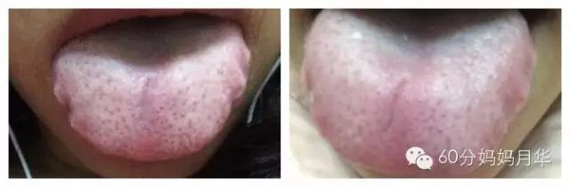 生完孩子后整天都感觉没力气怎么办?妈妈们需要多补血更关爱自己