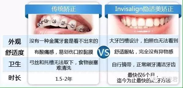 牙齿矫正舌侧牙套经历分享,牙齿矫正隐形牙套真人日记