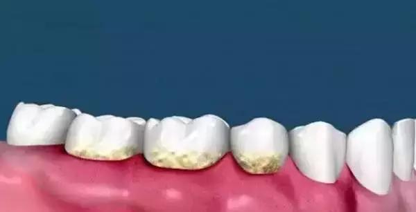 关于牙齿你需要知道的三件事,关于美白那些你不得不知道的事儿