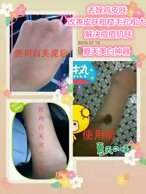 瓷肌美白怎么样效果好,瓷肌祛痘祛斑