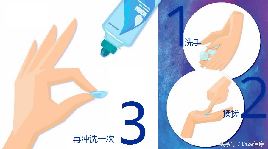 隐形眼镜戴久了干涩怎么解决,隐形眼镜戴久了干涩用什么药