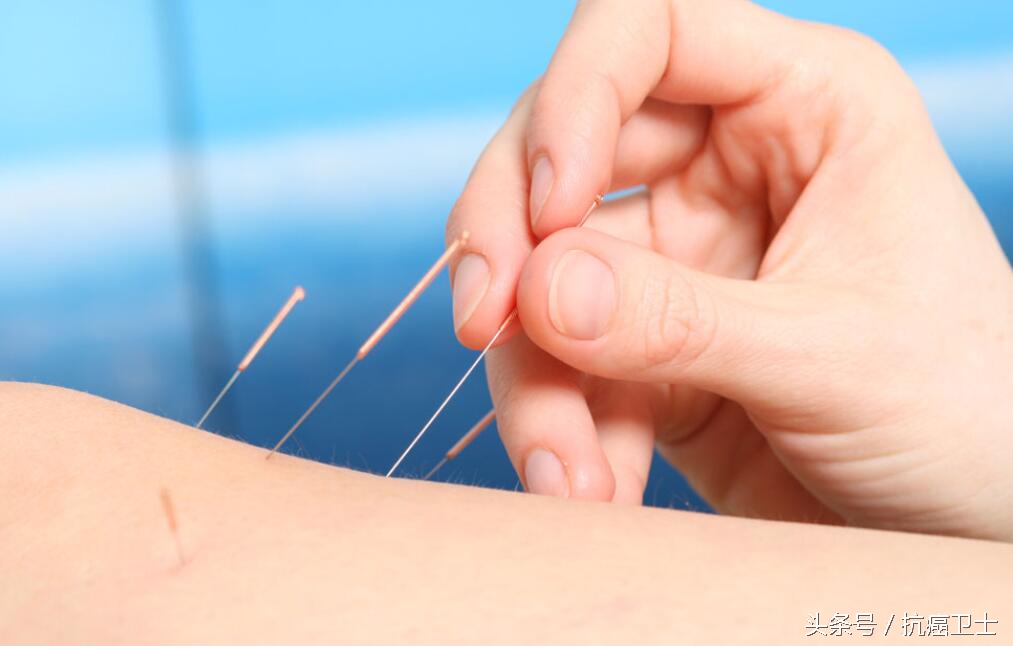 中医针灸理疗师证能针灸吗,中医针灸治疗癌症
