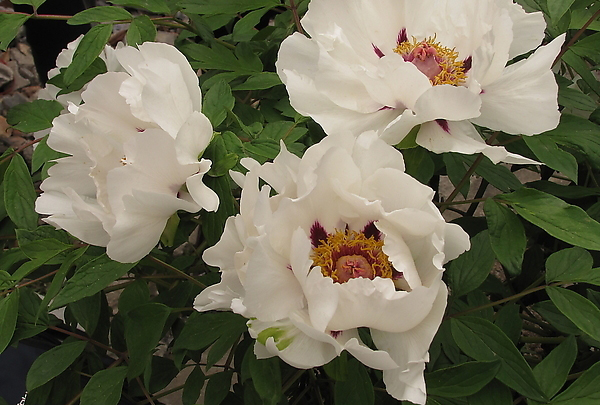 张仲景治腿抽筋的中成药,张仲景治疗腿抽筋的两个方子