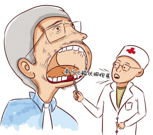 预防和减少口腔癌应做到哪些,预防和减少口腔癌发生应当做的事