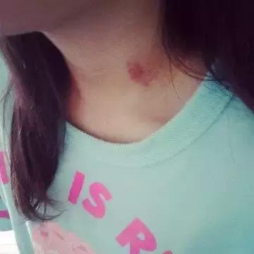 天呐！年轻情侣亲个嘴后