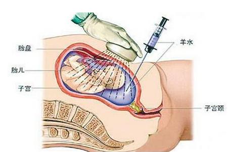 高龄高危产妇冒生命危险生二胎,高龄产妇生二胎的忠告