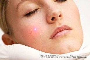 激光点痣后要注意哪些问题,激光点痣需要注意什么事项