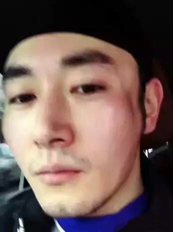 这个孙俪曾经“深爱”的男人,经历毁容却乐观积极!