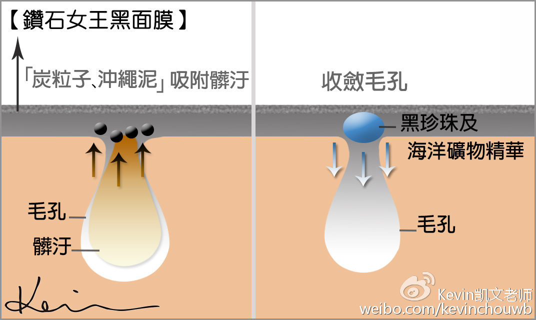 美妆去粉刺最有效的产品,痘痘粉刺黑头用什么化妆品