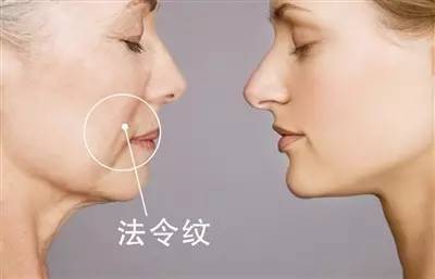 中医祛法令纹绝招,有效去法令纹的六大方法