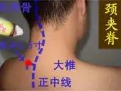 艾灸疗法调理经络不通,艾灸治疗肢体不温