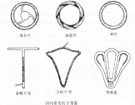 男人,如果你爱你的女人,就别让她上环!