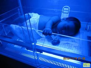 黄疸怎么治才能彻底退黄疸,黄疸最快退黄的办法