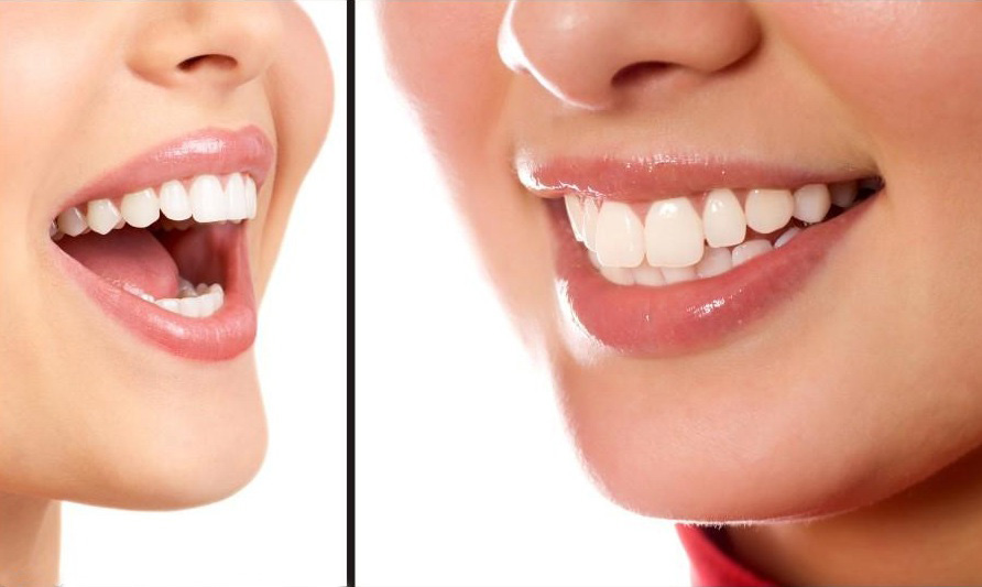 美女校花牙齿疼痛难忍，我用一个方子追到了她！