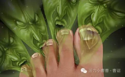 睡眠不好如何贴三伏贴,睡眠不好贴祛湿贴