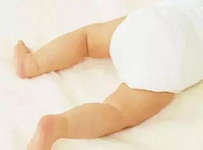 宝宝腿型不直先别急着去纠正，看看医生怎么说