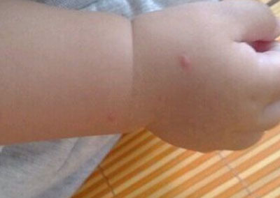 纹身夏天如何防止掉色,防止纹身掉色的方法