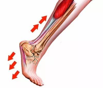 跟腱劳损跑步的利弊,跑步跟腱酸痛要多久恢复