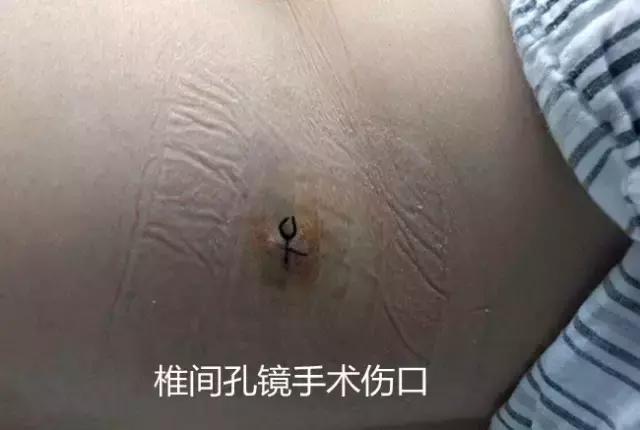 中心医院居然有“捉妖镜”，有患者亲眼目睹