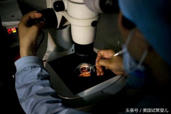 中国冷冻卵子,中国女子国外冷冻卵子