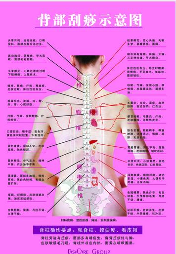 真正的刮痧方法,你真的会刮痧吗