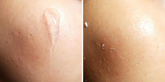 不要让脏脏的皮肤影响你的素颜,不要让脏脏的皮肤影响你的颜值