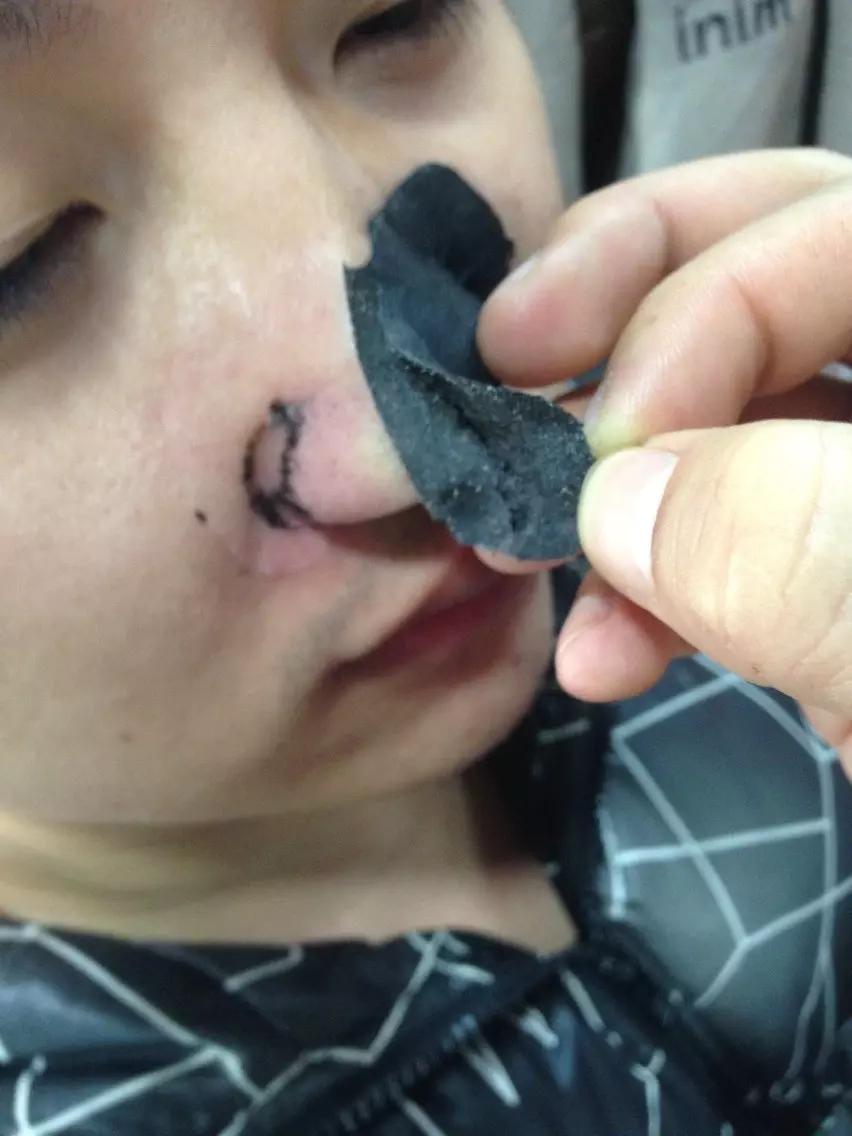 手把手教你有效去黑头的方法,手把手祛黑头