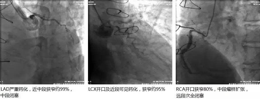 心力衰竭治疗要点的思维导图,心力衰竭疑难病例讨论记录模板