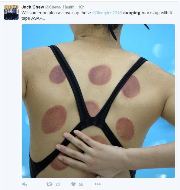 云健康丨一场奥运会，火了东方神秘的大中医