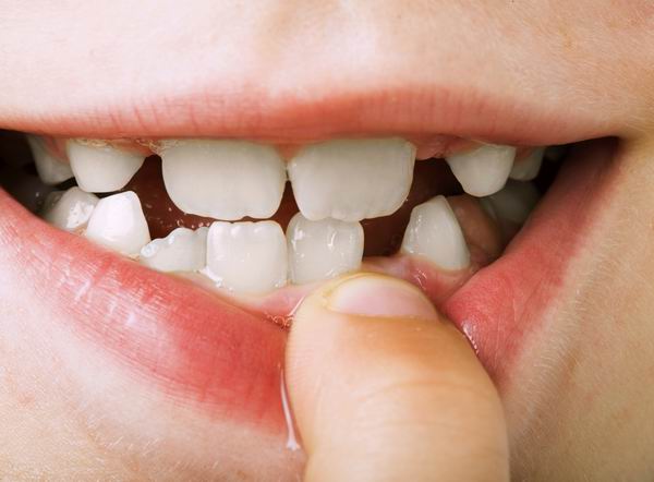 4岁开始换牙正常吗,5岁女宝换牙是不是早了