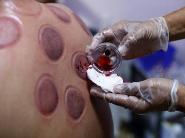 美国金牌得主赴京体验传统中医，当晚被我领进足疗保健打了一针兴奋剂