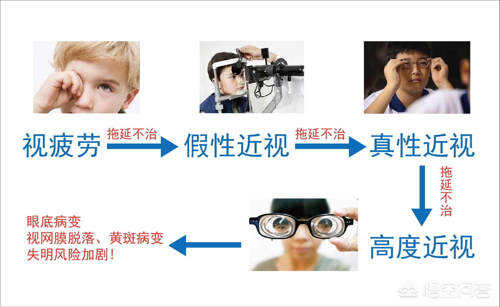 孩子近视了十大护眼妙招请收好,孩子近视了家长如何帮助调理