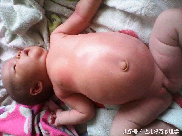 婴幼儿肚子咕噜咕噜响还放屁,婴儿肚子大鼓鼓的砰砰响正常吗