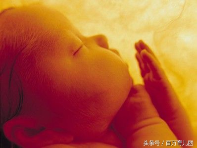 胎儿左侧脉络丛囊肿26周复查增大,胎儿脉络丛囊肿隔多久检查一次