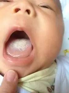 探索宝宝身上独特的秘密,探索宝宝的奇妙之旅