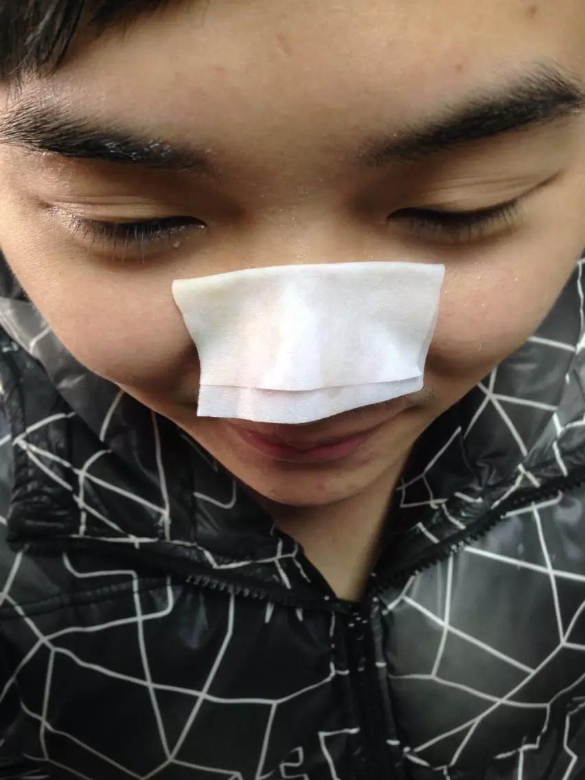 手把手教你有效去黑头的方法,手把手祛黑头